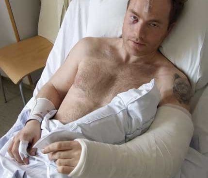 Johnny Smedbergs röjsåg fick en björnhona att komma ut ur idet. Kirurger fick jobba hårt för att rädda hans vänsterarm som slets sönder av den hundra kilo tunga björnen.