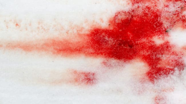 – Det är oroande, och otillfredsställande, att det får gå till på det här sättet, säger försvarsadvokat Sven Severin.