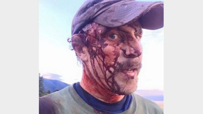 Efter att ha attackerats två gånger av samma grizzlyhona filmade Todd Orr sig själv innan han körde till sjukhus för vård. Han klarade sig med flertalet bitskador.